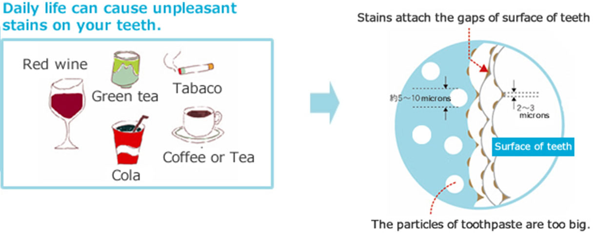 Daily life can cause unpleasant stains on your teeth.