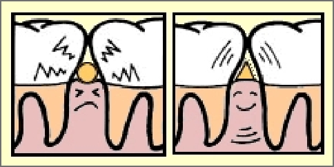 Dental pic